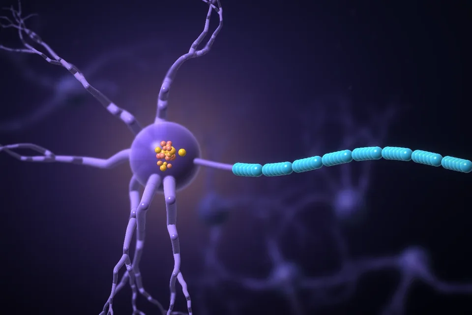 A neuron with protein aggregates in its cell body